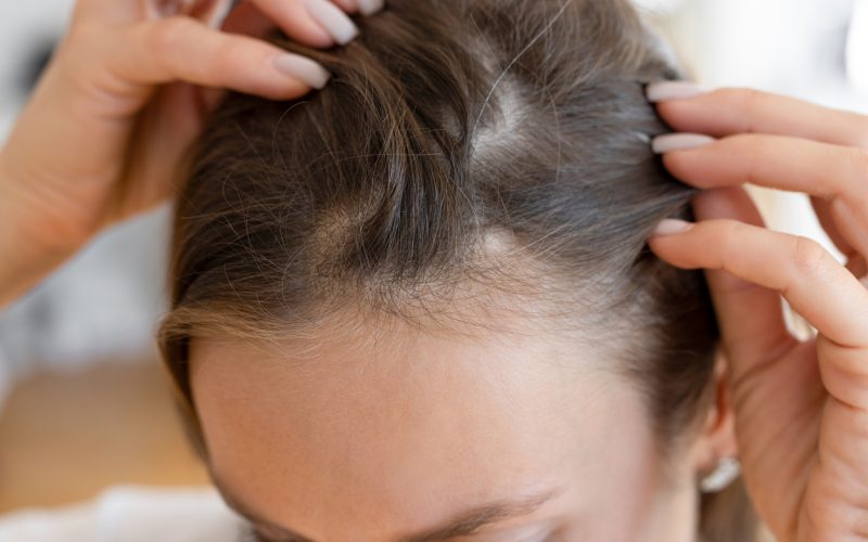 Unrecognizable woman has problems with hair Unrecognizable woman has problems with hair and scalp